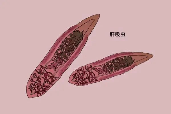 预防措施:避免感染肝吸虫,最重要的是要把住病从口入关