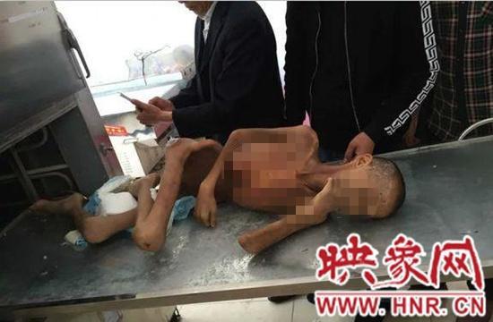 9岁男童走失半年饿死救助站 发现时成“干尸”